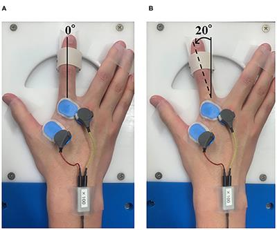 Effect of Repetitive Passive Movement Before Motor Skill Training on Corticospinal Excitability and Motor Learning Depend on BDNF Polymorphisms